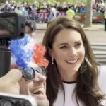 kate middleton cirugia abdominal