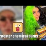 beasteater chemical burns video