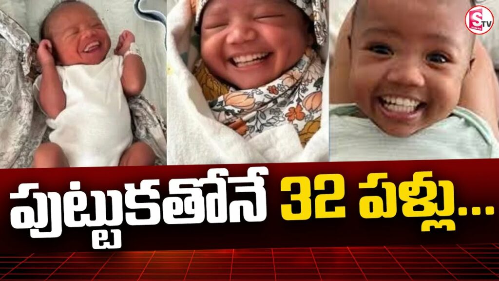 video baby born with 32 teeth