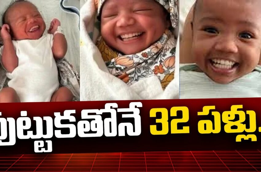  పుట్టుకతోనే 32 పళ్లు  వైరల్ వీడియో