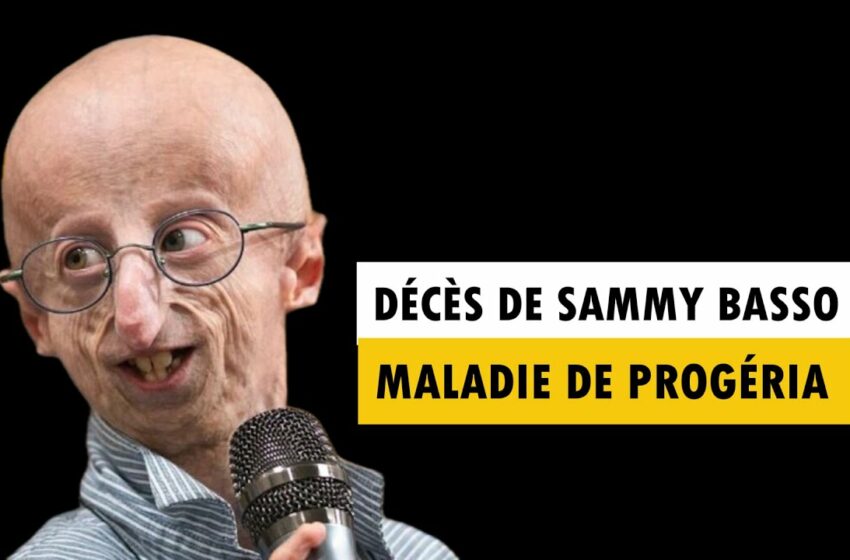  sammy basso progeria