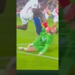 gianluigi donnarumma facial inju